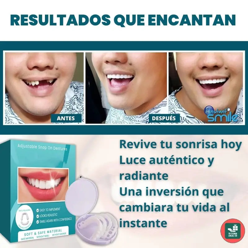 CARILLAS DENTALES TT SNAP ON DENTURE UN CAMBIO QUE TRANSFORMA TU VIDA AL INSTANTE