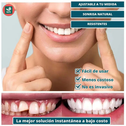 CARILLAS DENTALES TT SNAP ON DENTURE UN CAMBIO QUE TRANSFORMA TU VIDA AL INSTANTE
